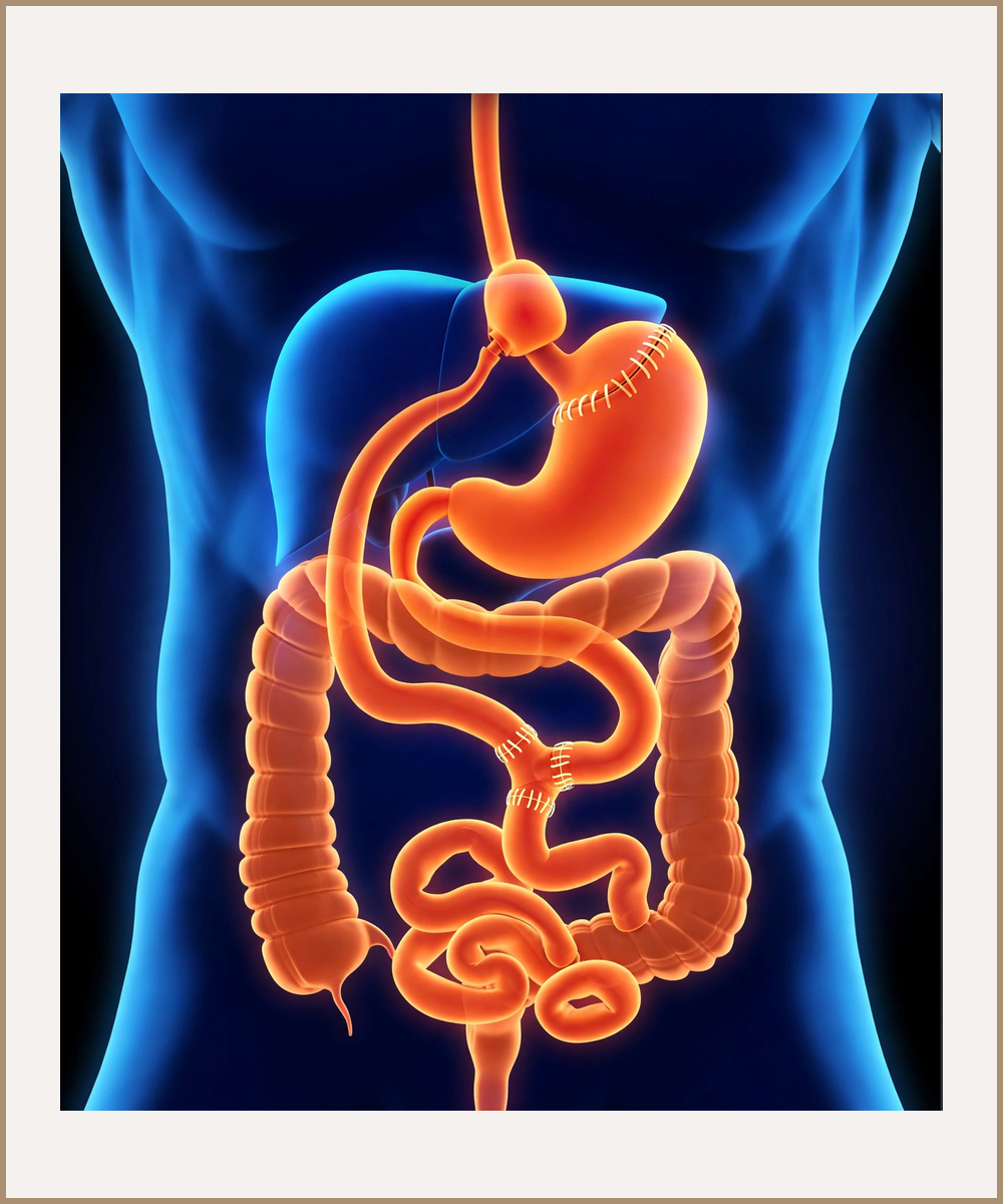 Illustration of a Roux-en-Y gastric bypass