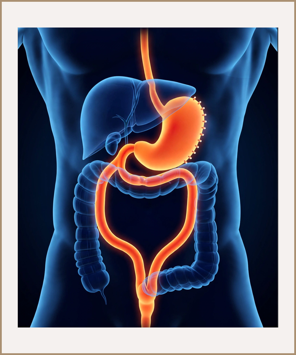 Illustration of a biliopancreatic diversion with duodenal switch